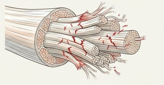 Akute Sehnen- und Bandprobleme